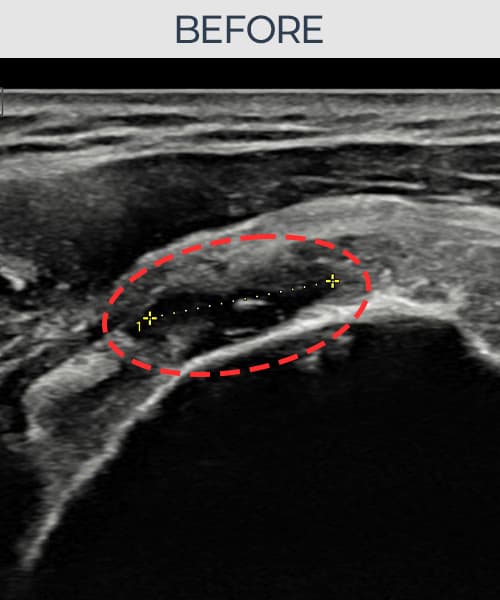 症例 No.1 — 施術前