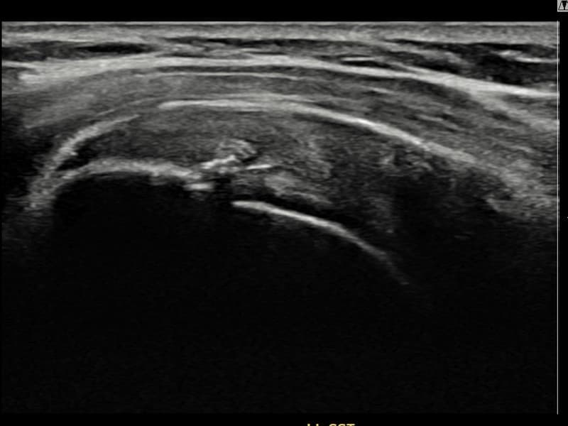 症例 No.11 — 施術後