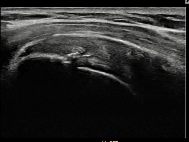 김ㅇㅇ님 시술 후
