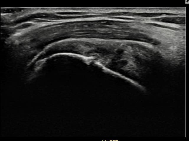 김ㅇㅇ님 시술 전