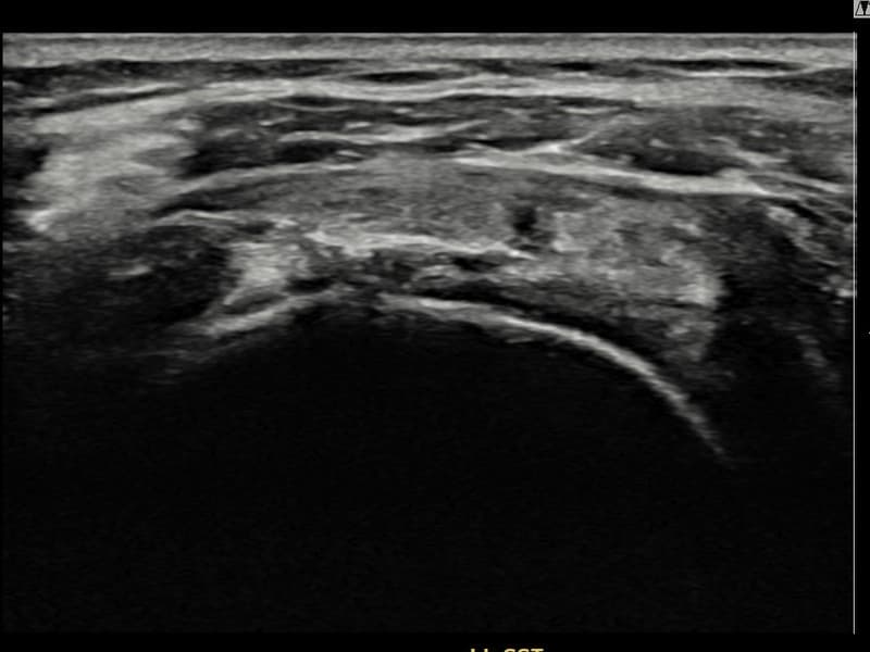 症例 No.12 — 施術後