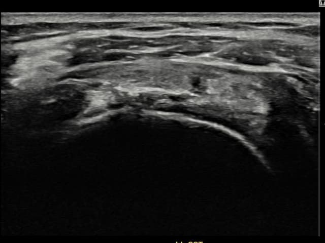 ケース 12 施術後