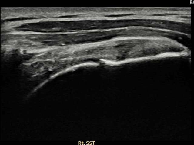 ケース 13 施術後