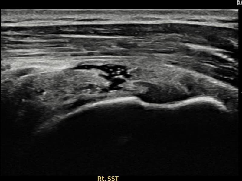 病例No.13 — 术前