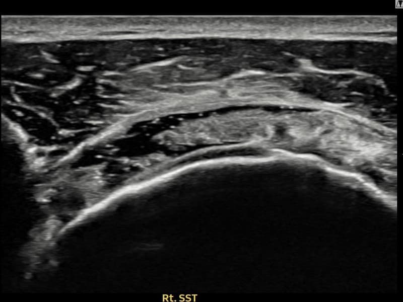 病例No.14 — 术前
