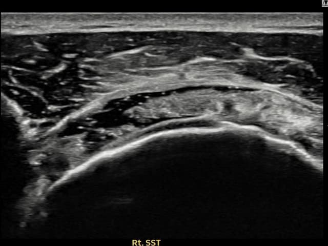 이ㅇㅇ님 시술 전