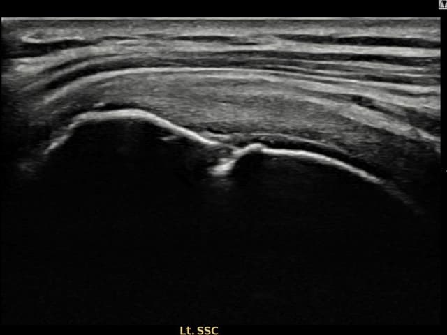 ケース 15 施術後