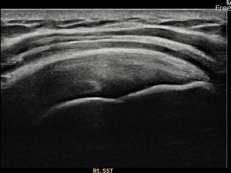 病例No.16 — 术后