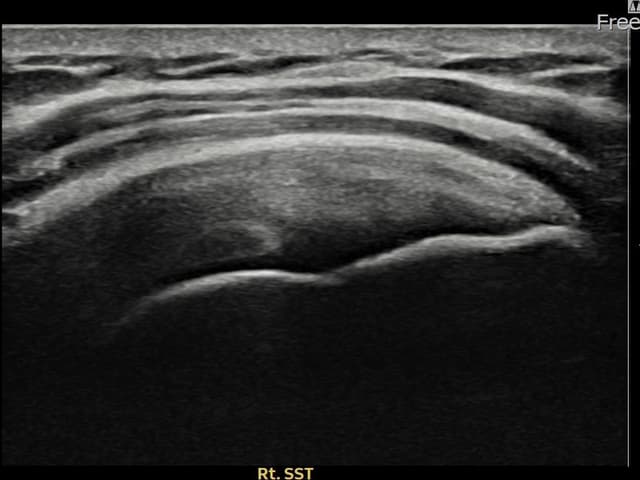 ケース 16 施術後