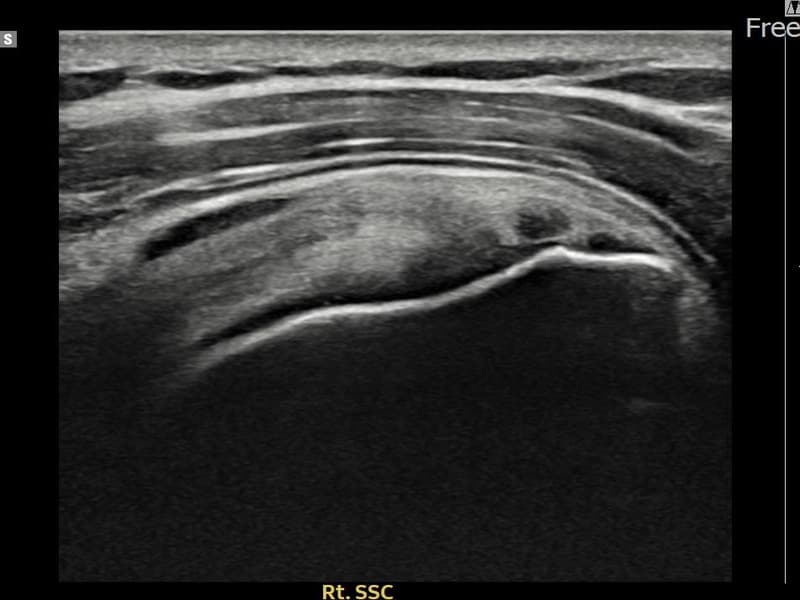 病例No.16 — 术前