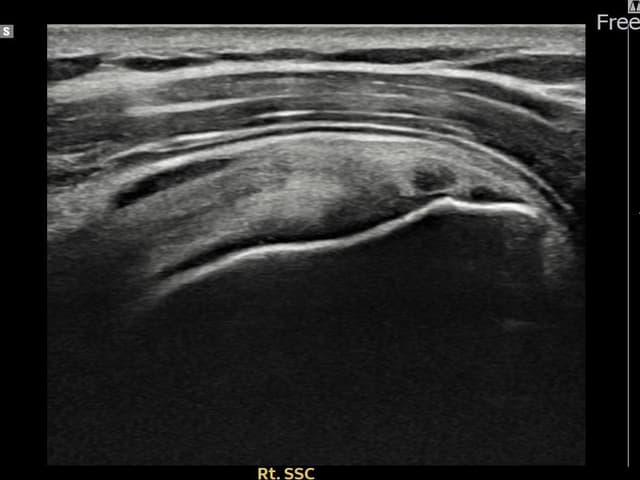 ケース 16 施術前