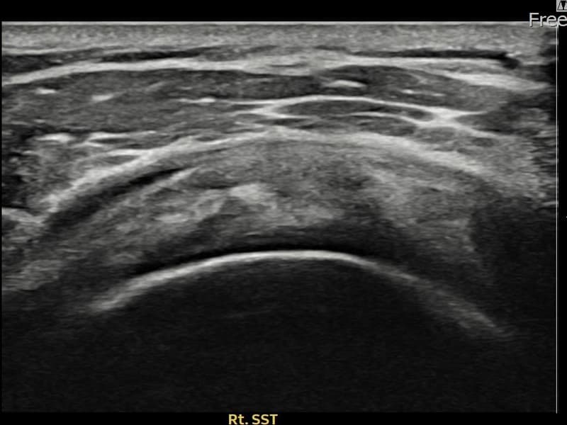 症例 No.17 — 施術後