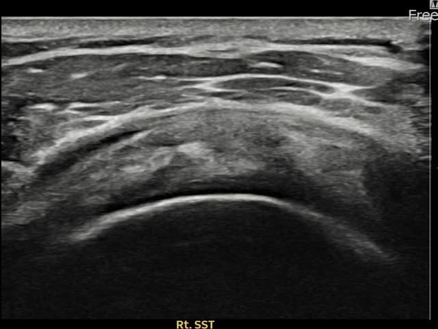 유ㅇㅇ님 시술 후