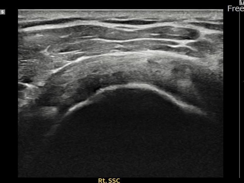 症例 No.17 — 施術前