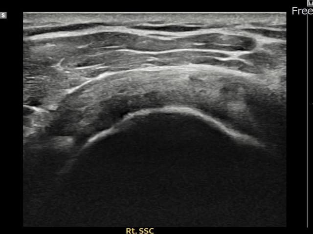 유ㅇㅇ님 시술 전