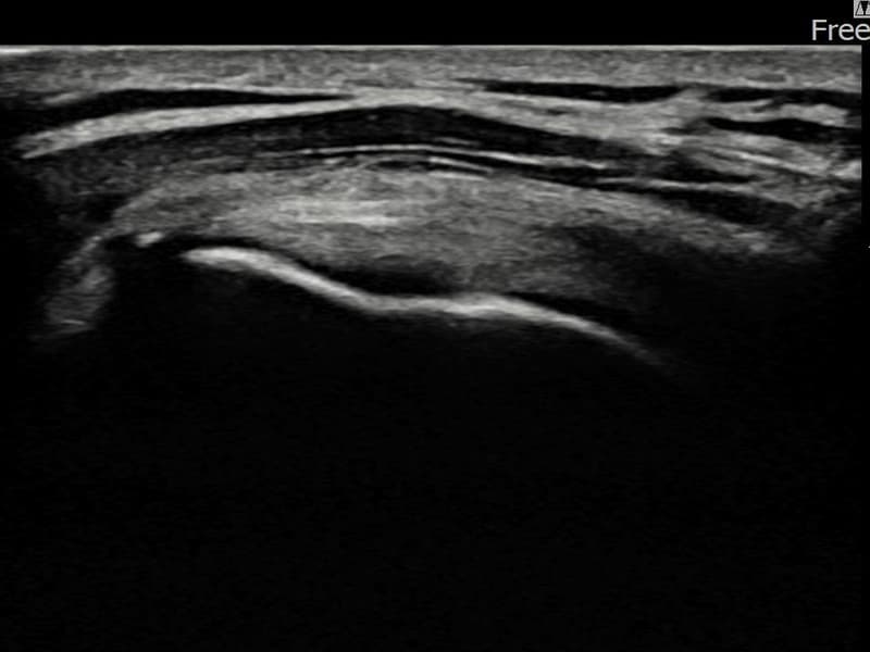 症例 No.18 — 施術後