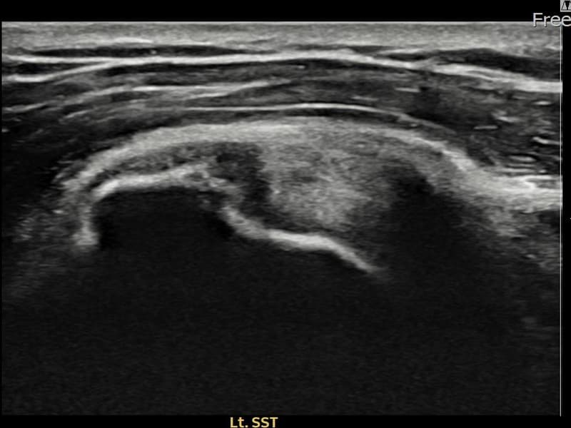 症例 No.18 — 施術前