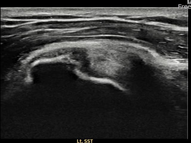 ケース 18 施術前