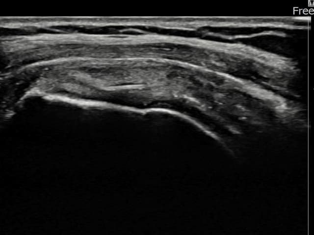 ケース 19 施術後