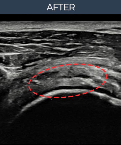 病例No.2 — 术后