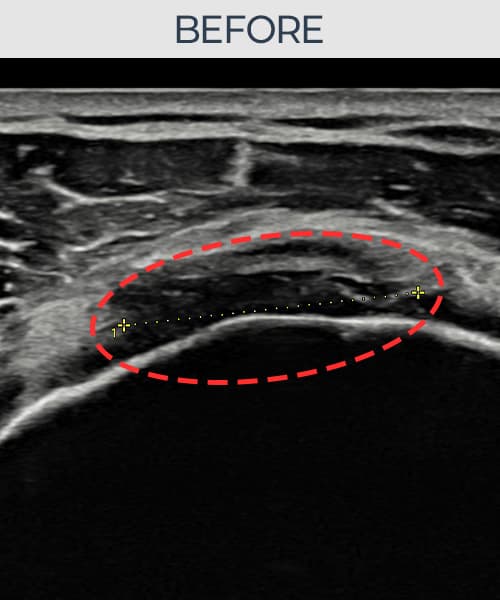 病例No.2 — 术前