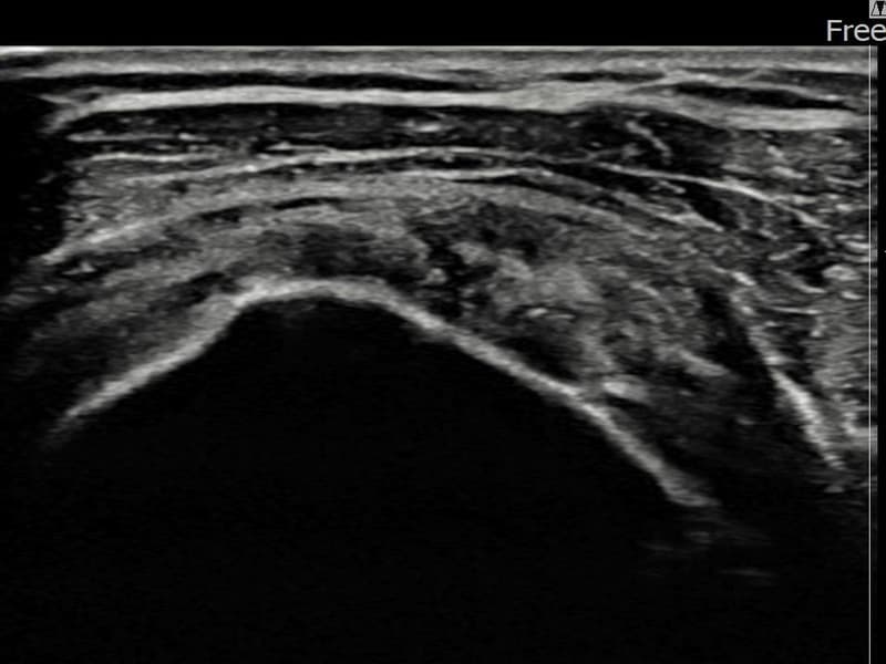 症例 No.20 — 施術後