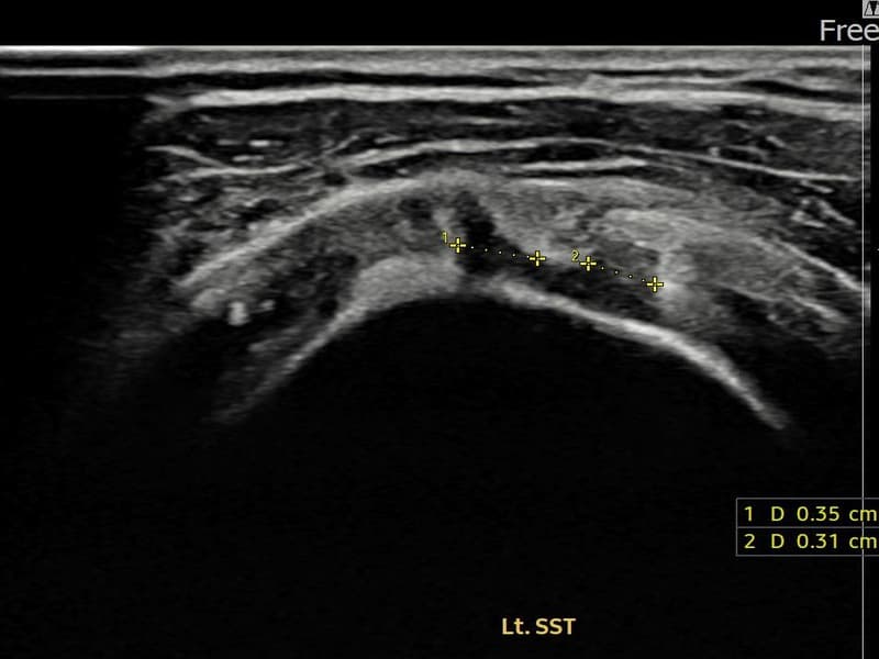 症例 No.20 — 施術前