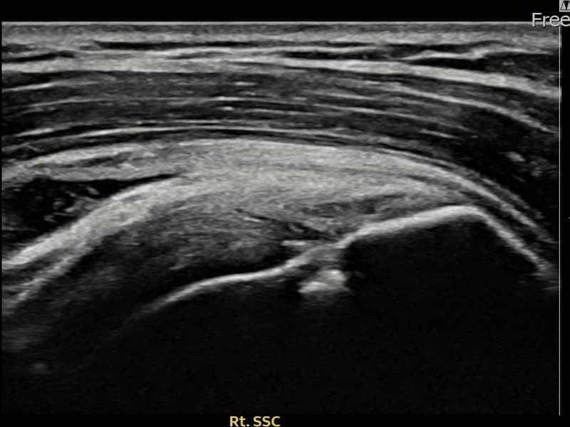 症例 No.22 — 施術後