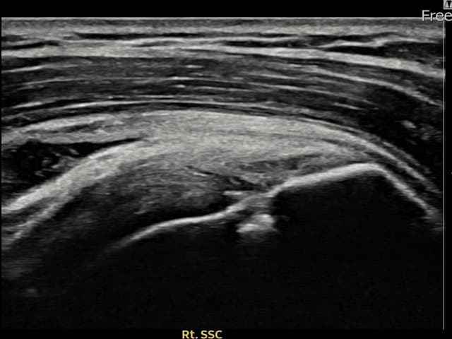 ケース 22 施術後