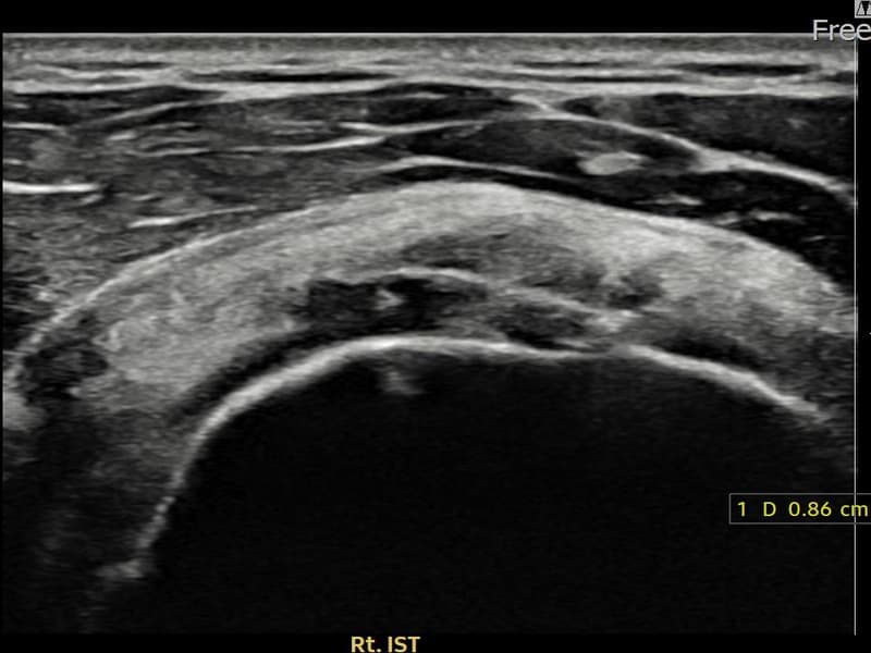 症例 No.22 — 施術前