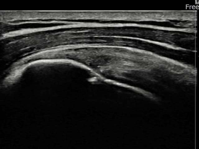 ケース 23 施術後