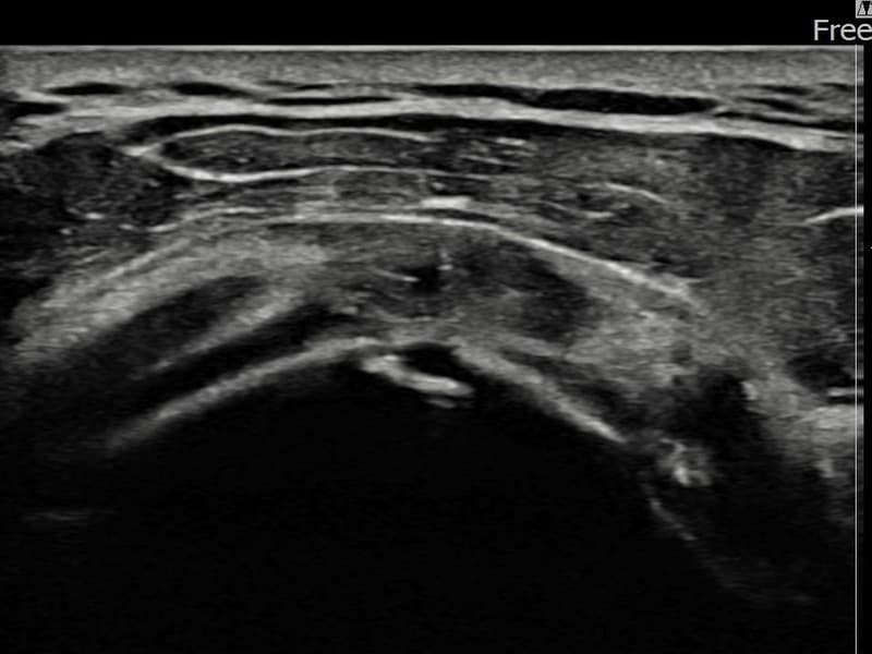 症例 No.24 — 施術後