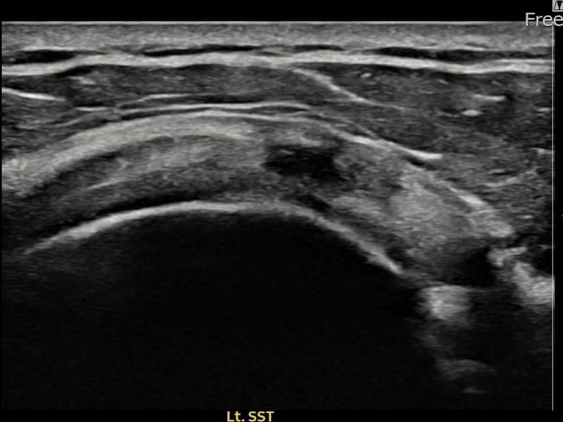 症例 No.24 — 施術前