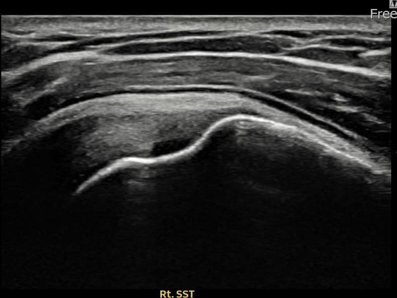 症例 No.25 — 施術後