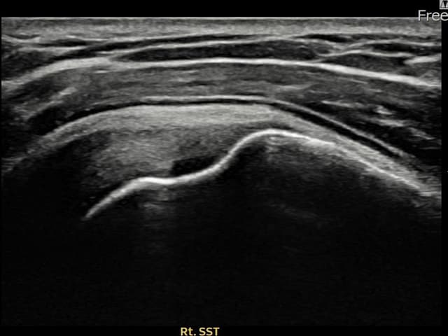 ケース 25 施術後