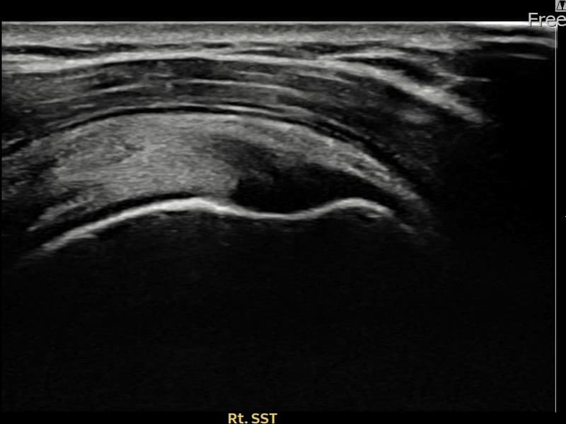 症例 No.25 — 施術前