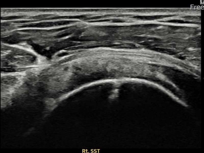 症例 No.26 — 施術後