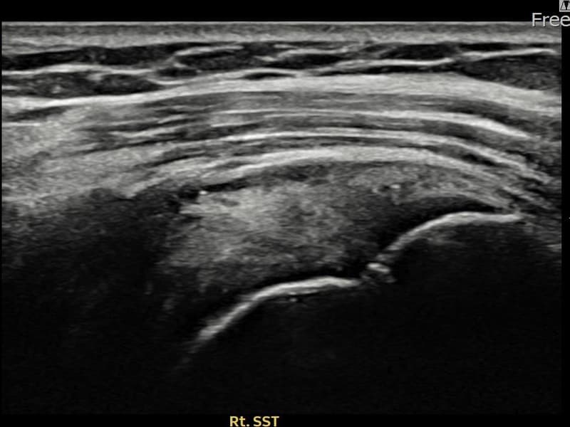 症例 No.27 — 施術後