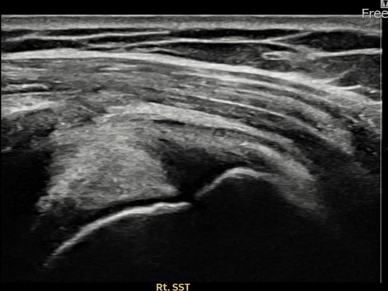 症例 No.27 — 施術前