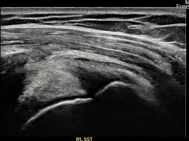 ケース 27 施術前
