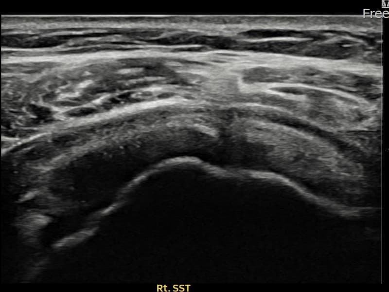 症例 No.28 — 施術前