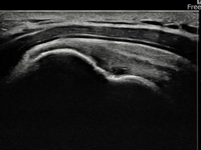 ケース 29 施術後