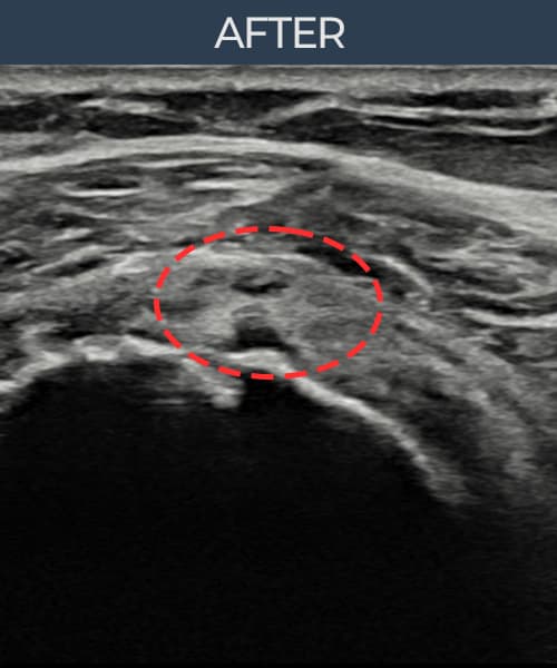 症例 No.3 — 施術後