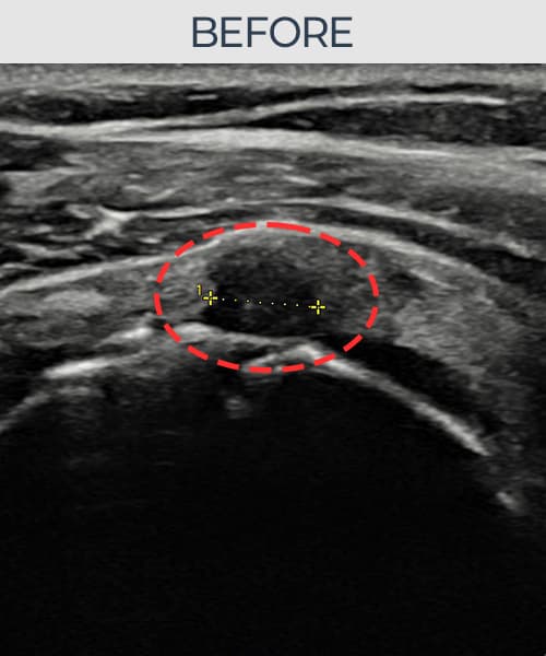 ケース 3 施術前