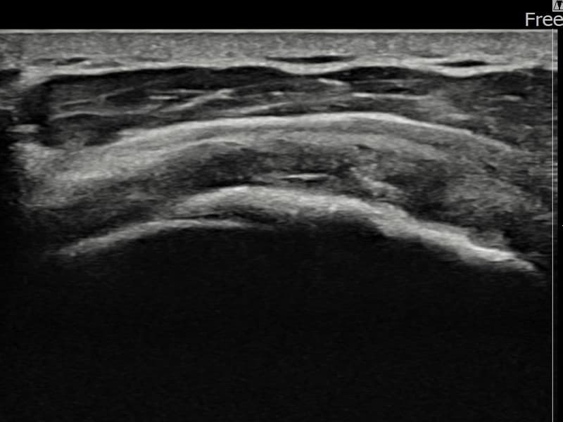 症例 No.30 — 施術後