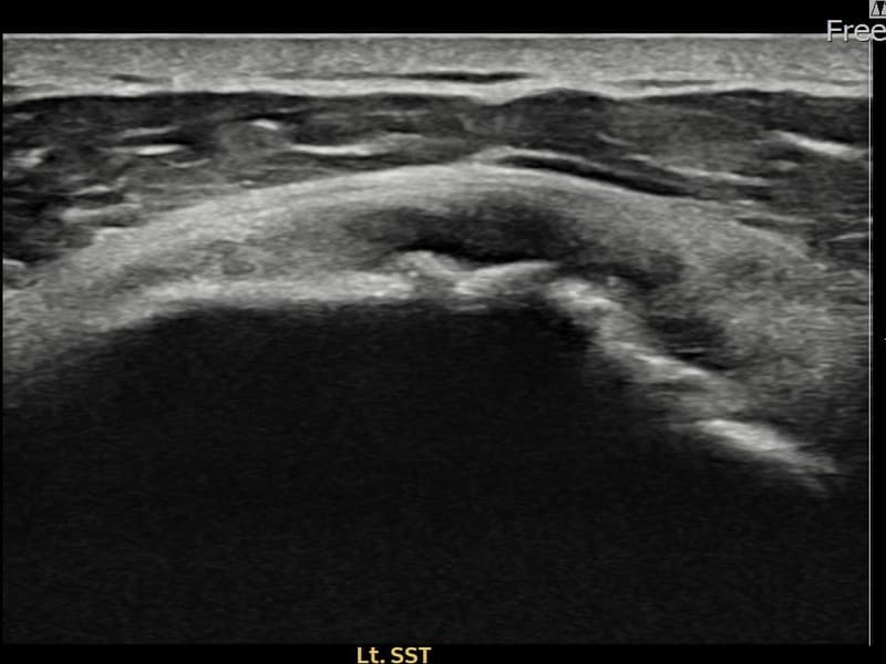 症例 No.30 — 施術前