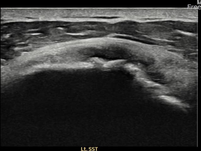 김ㅇㅇ님 시술 전