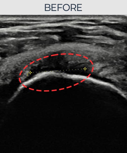 症例 No.4 — 施術前