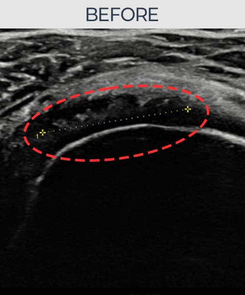 症例 No.5 — 施術前