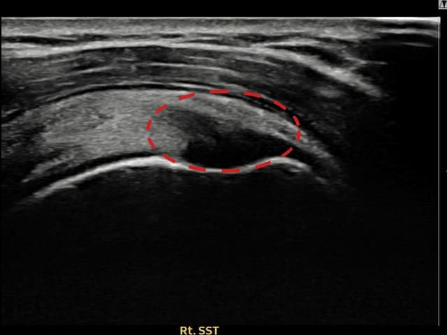 ケース 6 施術前